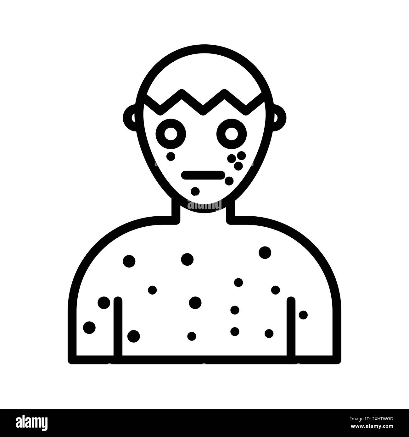 Boy chicken pox icon linear logo mark set collection in black and white