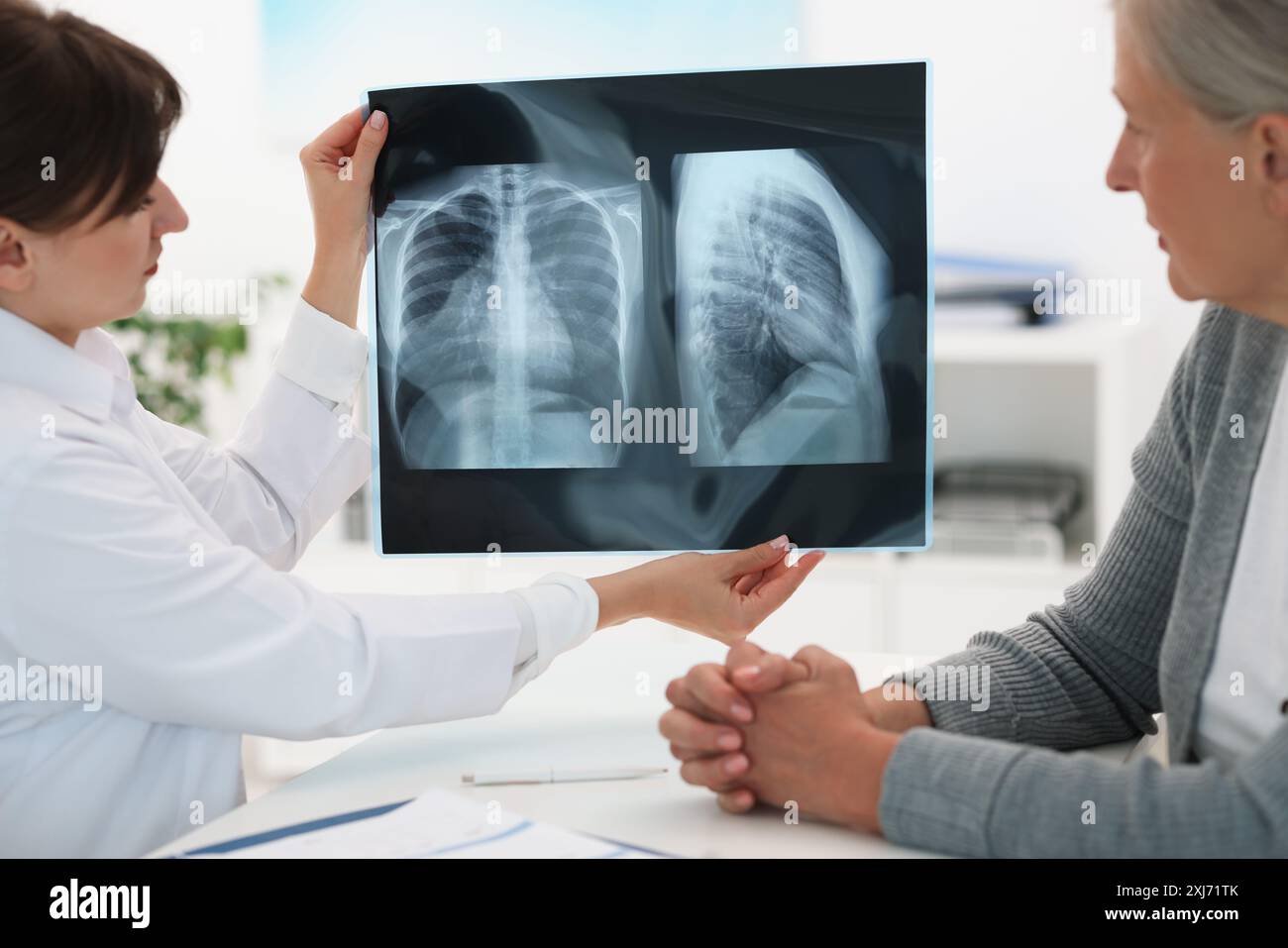 Lung disease. Doctor showing chest x-ray to her patient at table in ...