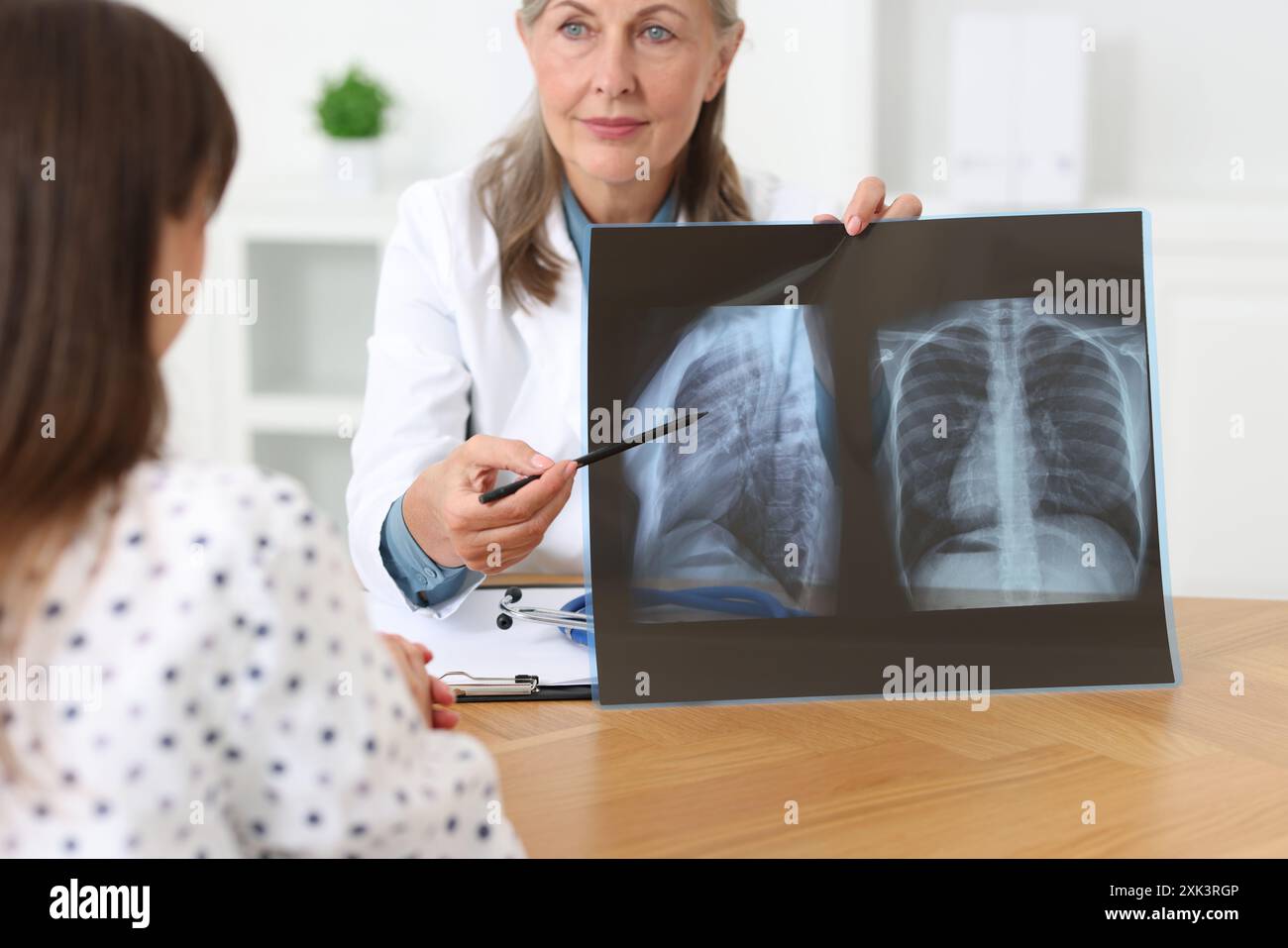 Patient Chest Lung disease. Doctor showing chest x-ray to her patient in clinic Stock ...