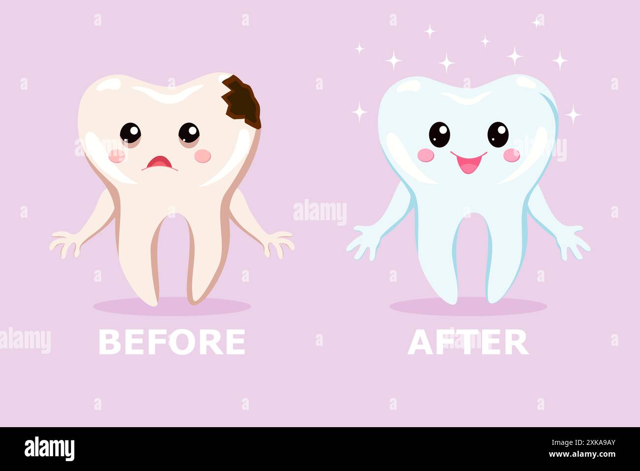 A sad tooth with caries and a healthy happy tooth before and after treatment. Dental treatment concept for pediatric dentistry. Cute dental cartoon ch Stock Vector