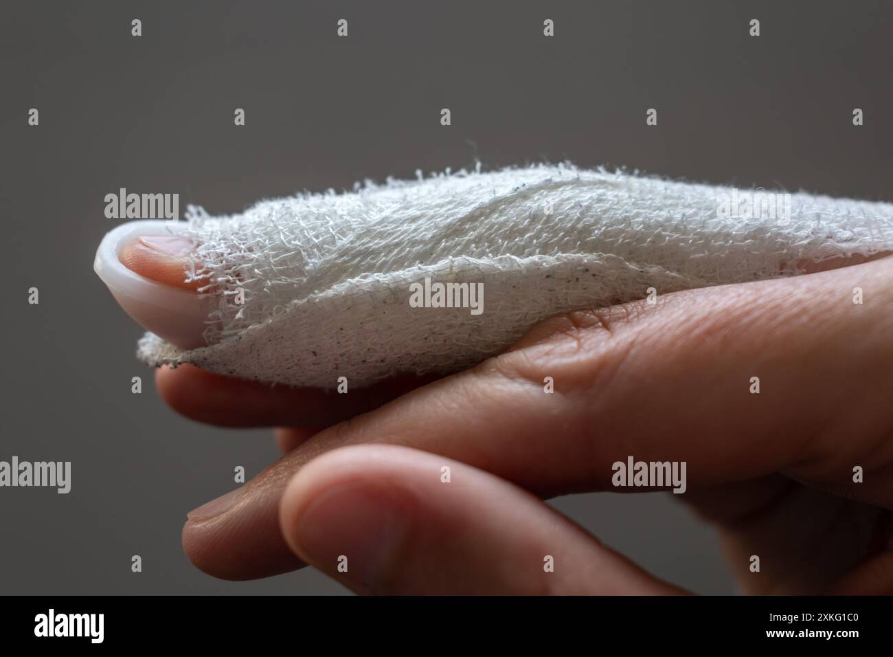 Finger tendon rupture hi-res stock photography and images - Alamy