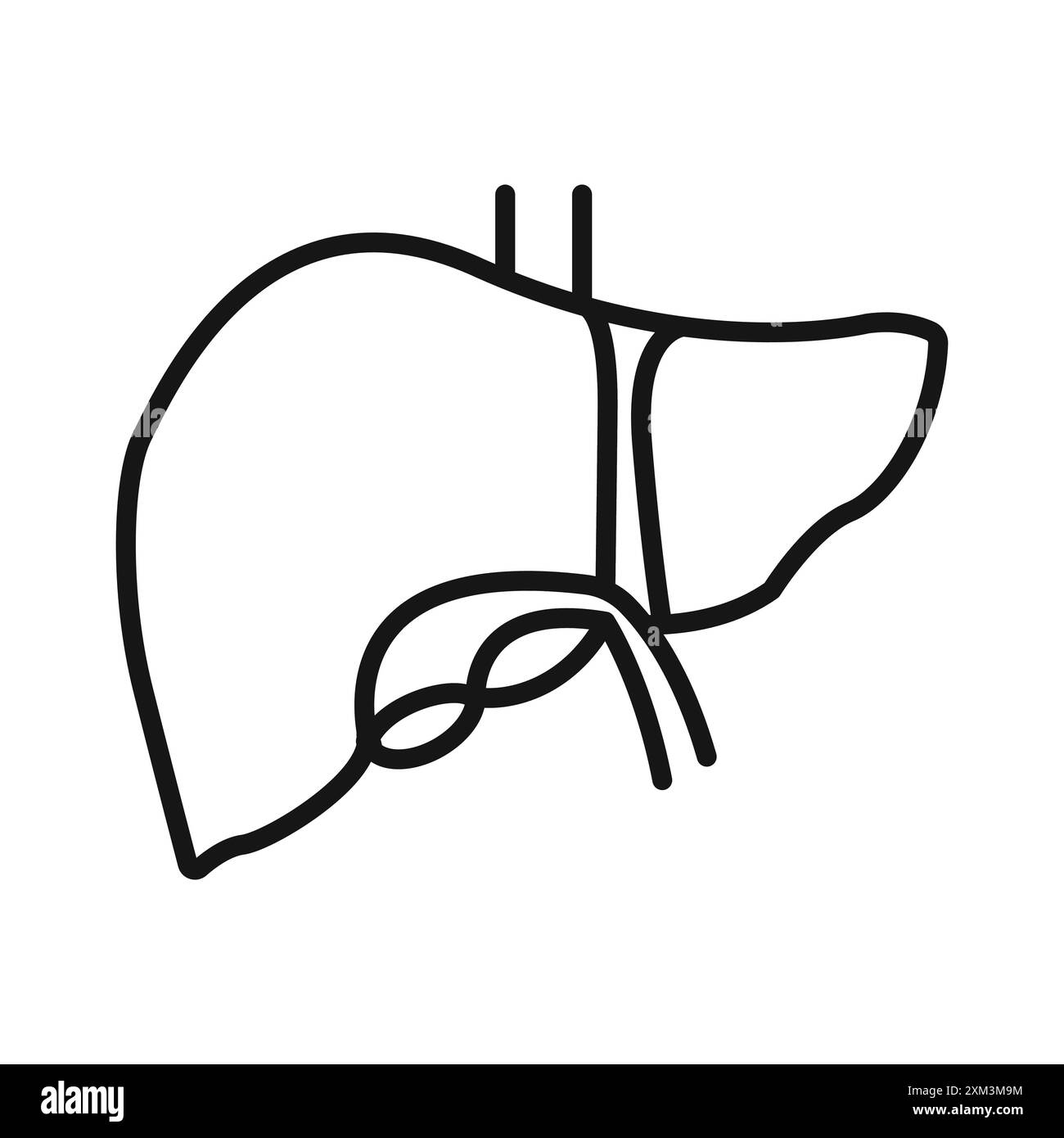 Bladder disease Black and White Stock Photos & Images - Alamy
