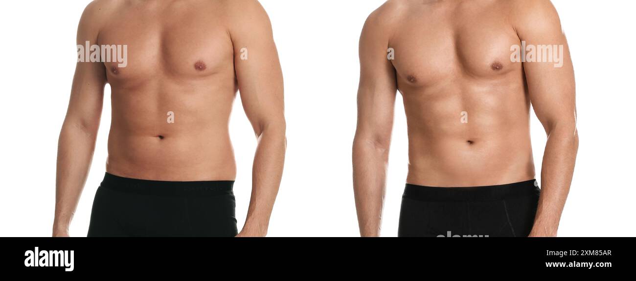 Man showing body before and after weight loss on white background, closeup Stock Photo