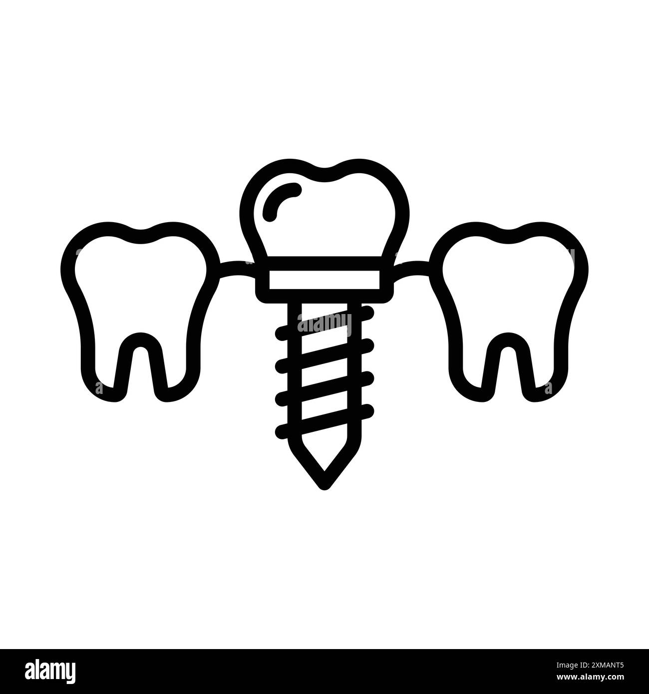 Dental implants icon linear logo mark set collection in black and white for web Stock Vector