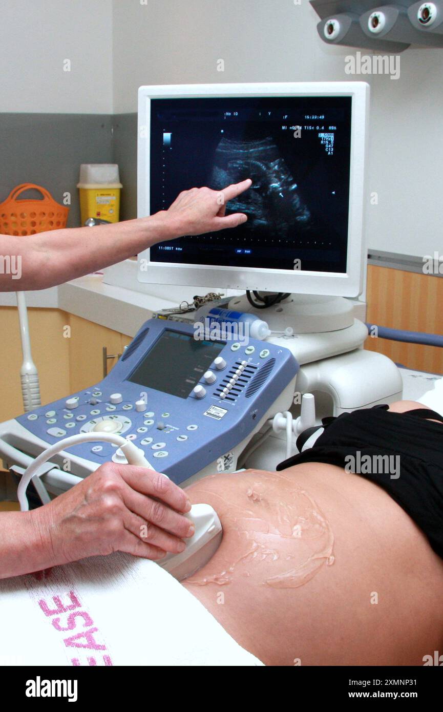 pregnant-woman-ultrasound-hi-res-stock-photography-and-images-alamy