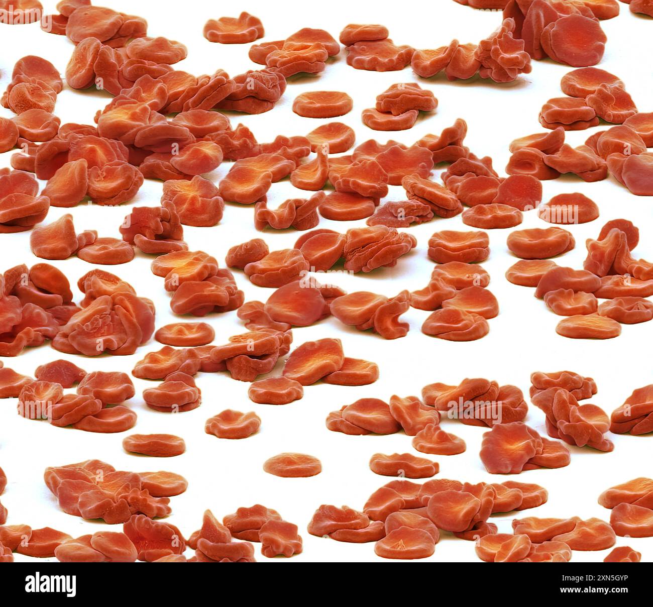 Red blood cells. Coloured scanning electron micrograph (SEM) of red ...