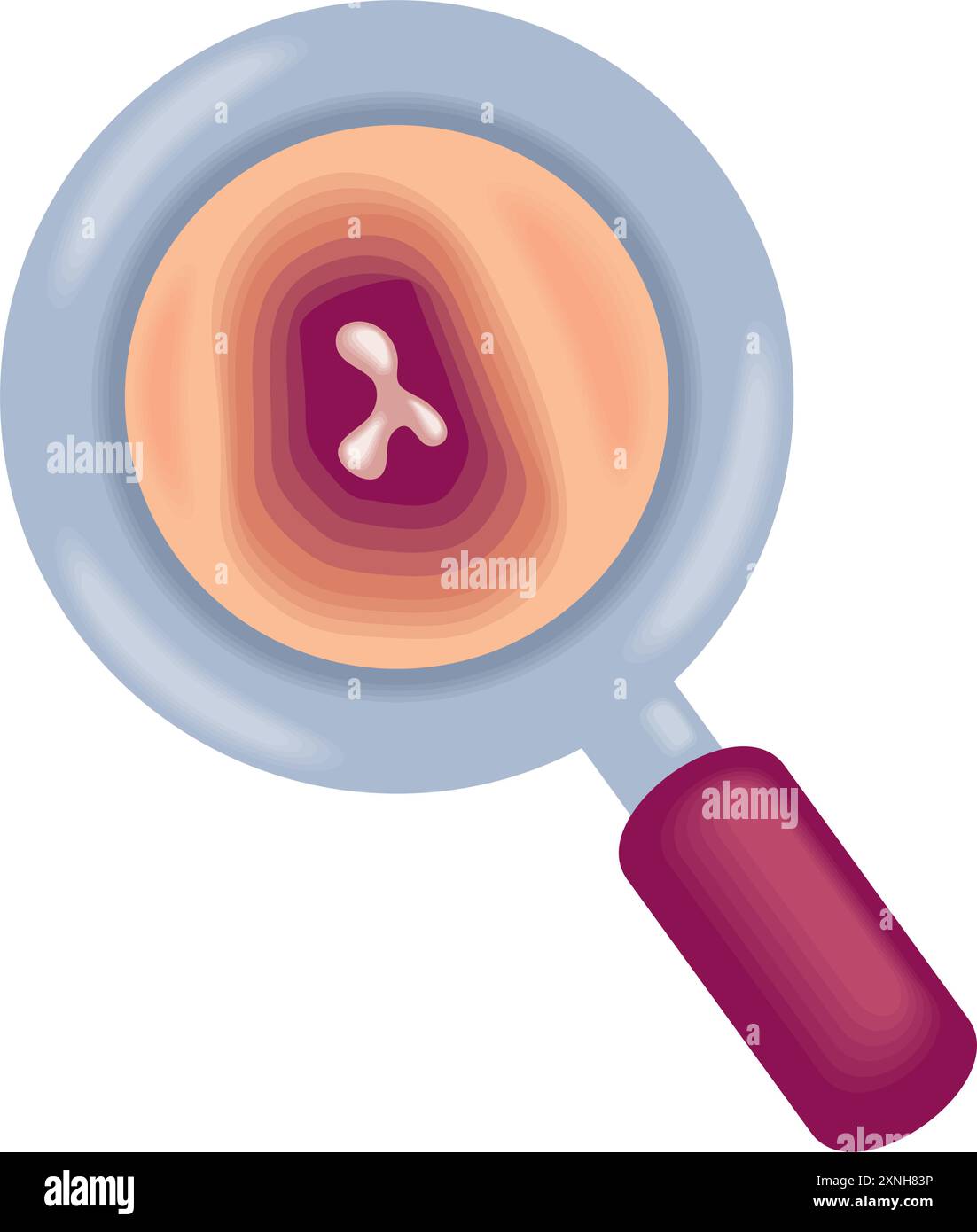 multiple myeloma bone marrow cancer Stock Vector Image & Art - Alamy