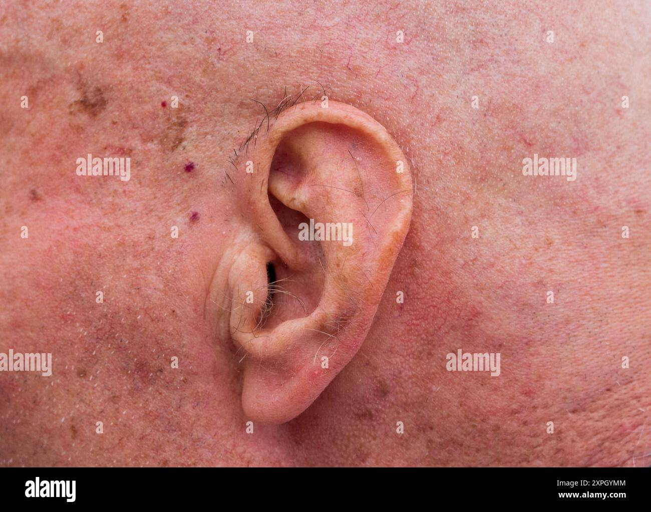 Close-Up look of an Old Man's Ear: 'Hear Me Out' Concept. Human skin background. Medical Care. Stock Photo