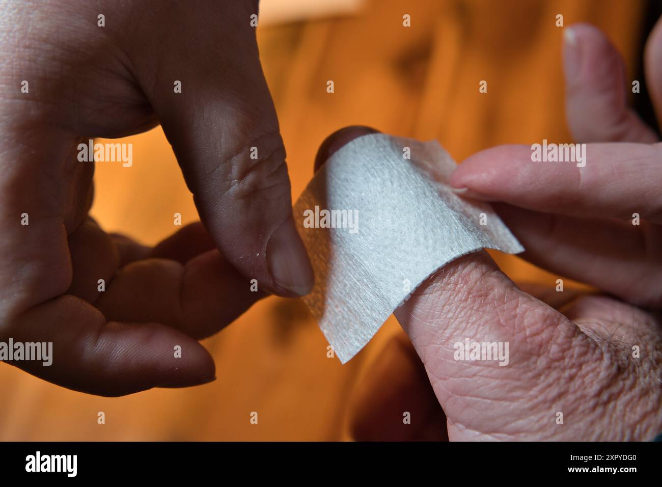 the injured thumb gets a plaster Stock Photo - Alamy