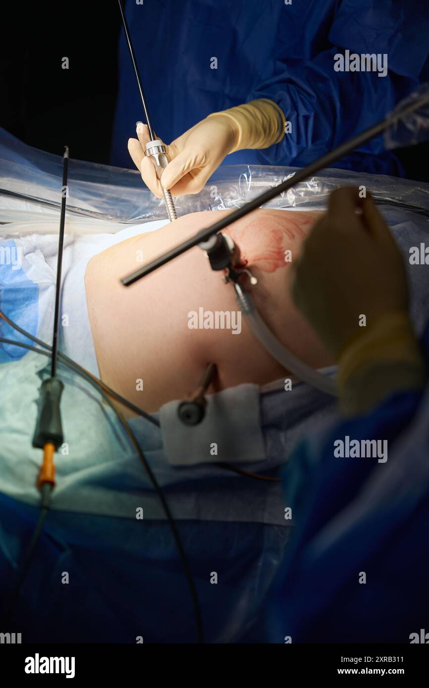 Operative Intervention Medical procedure for treating a patient with a surgical intervention ...