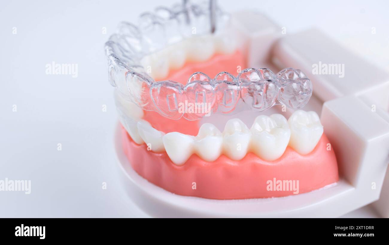 Man adjusting transparent aligners hi-res stock photography and images ...