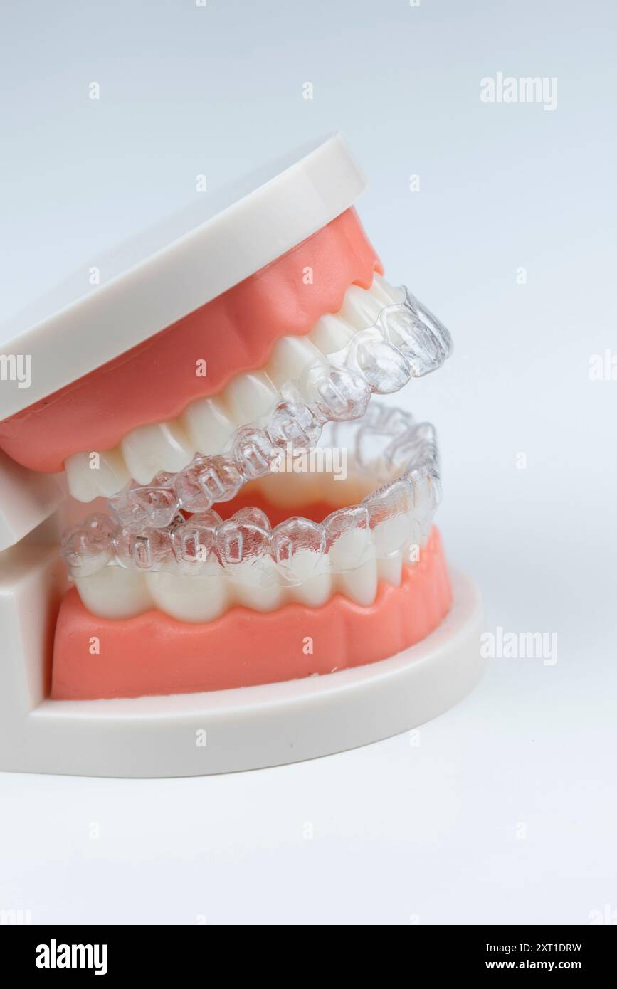 Man adjusting transparent aligners hi-res stock photography and images ...