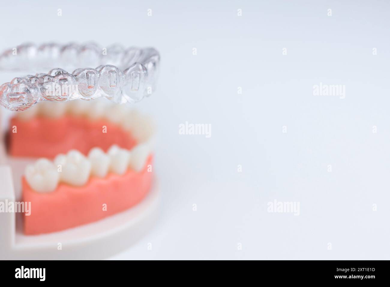 Man adjusting transparent aligners hi-res stock photography and images ...