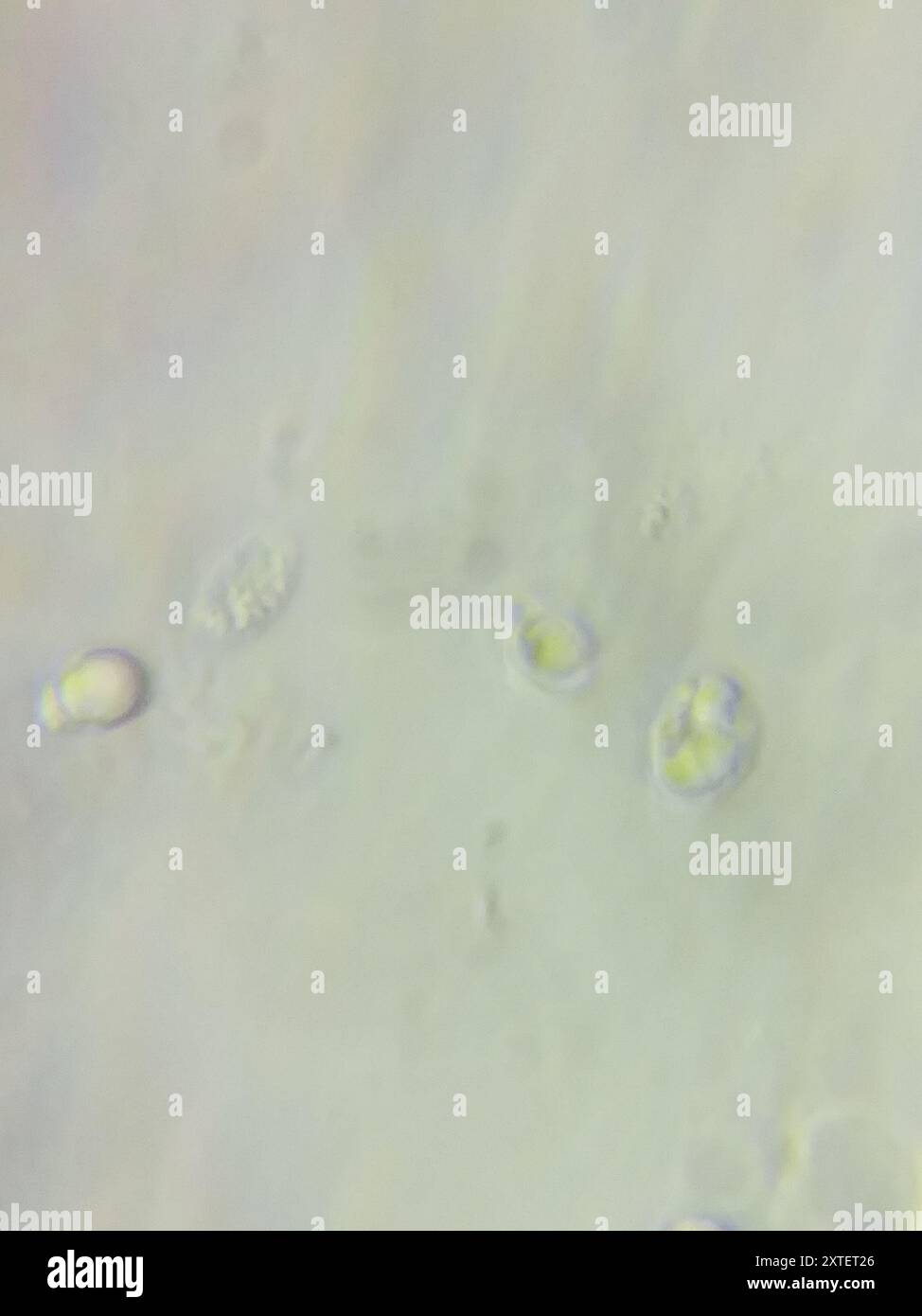 wallemia-mellicola-fungi-stock-photo-alamy