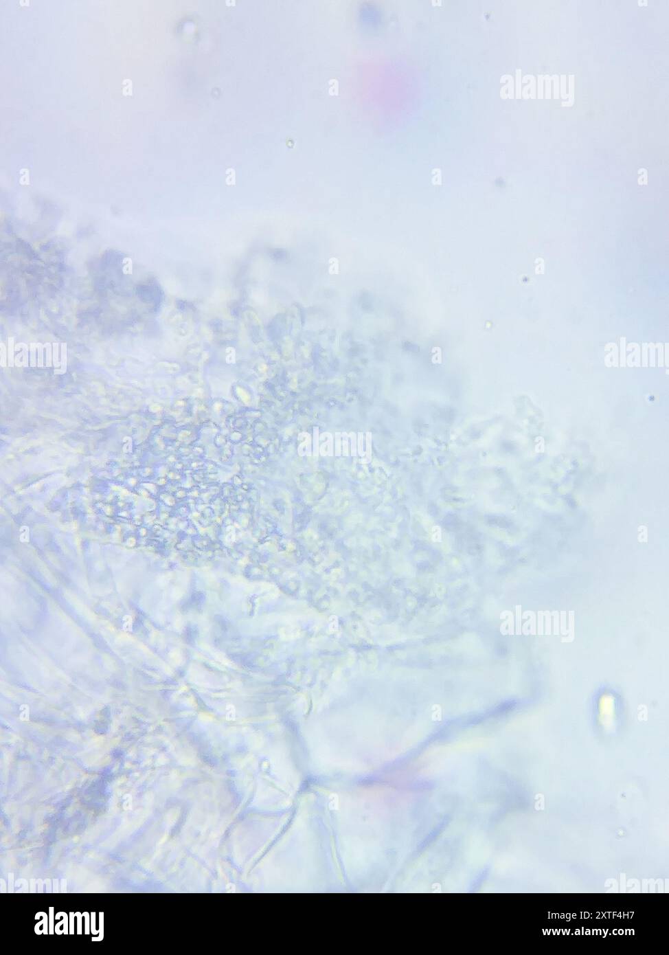 wallemia-mellicola-fungi-stock-photo-alamy