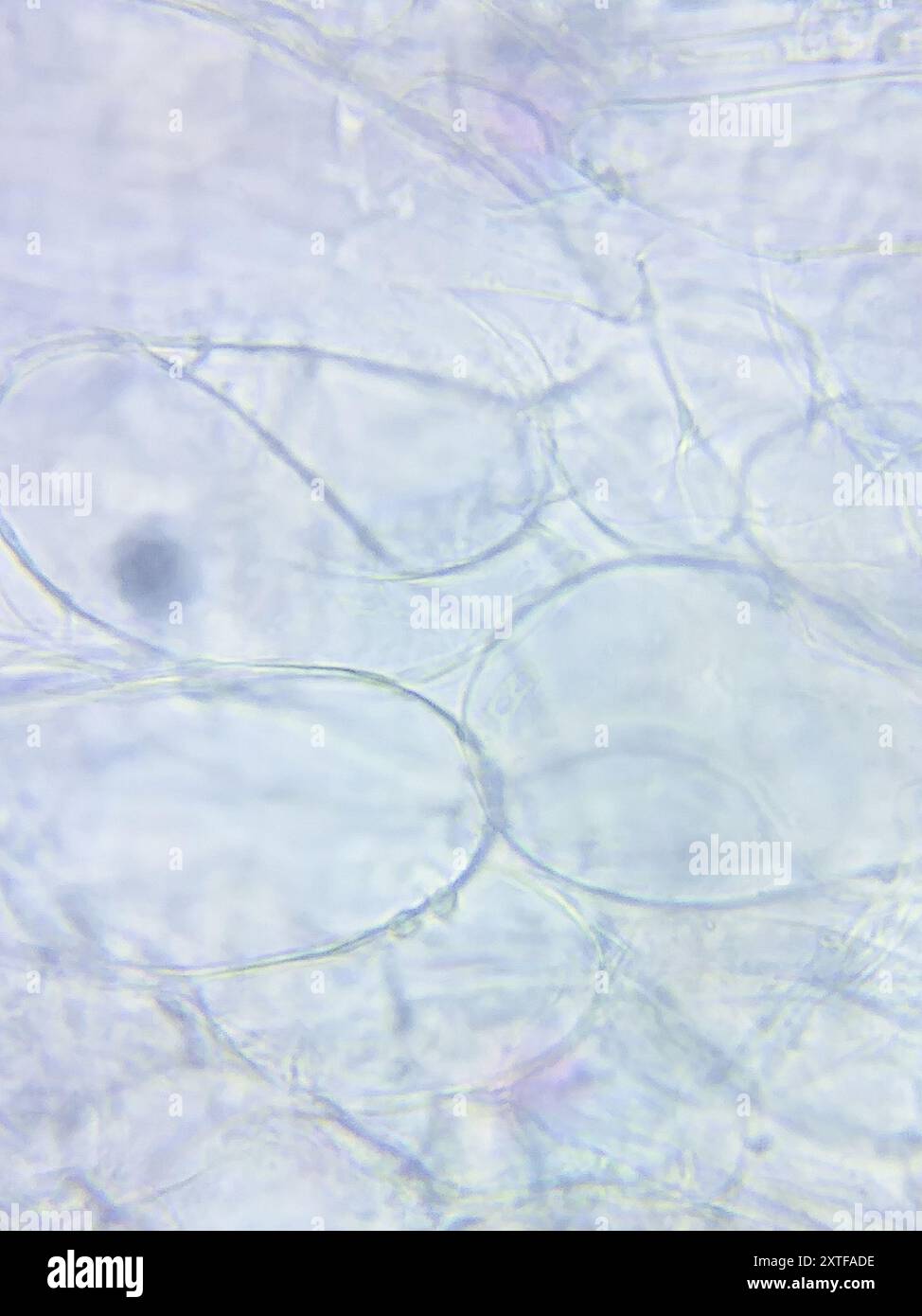 wallemia-mellicola-fungi-stock-photo-alamy