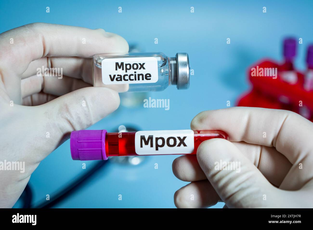 Monkeypox who hi-res stock photography and images - Alamy