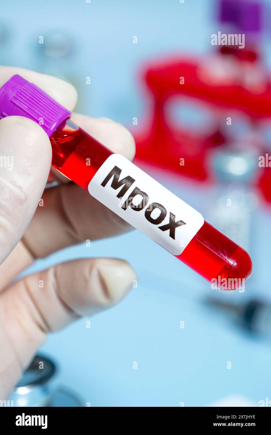 Viral blood infection hi-res stock photography and images - Alamy