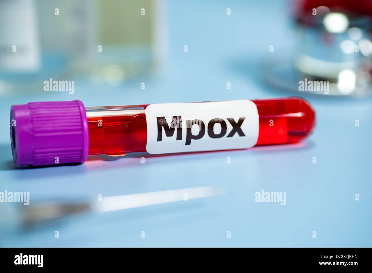Monkeypox who hi-res stock photography and images - Alamy