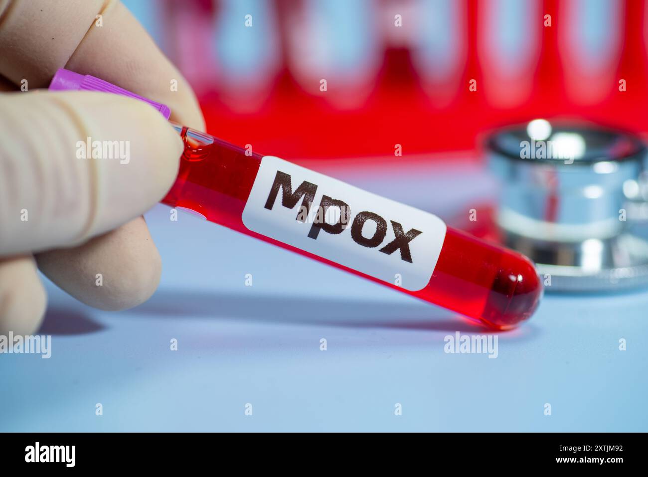 Infection results hi-res stock photography and images - Alamy