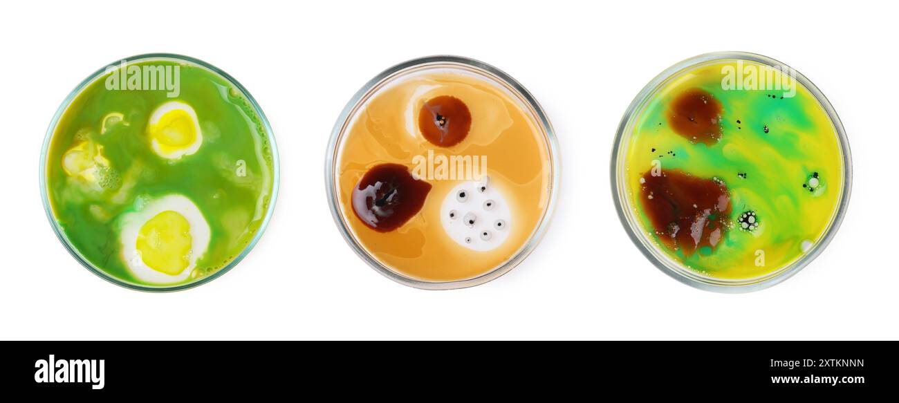 Set of Petri dishes with different bacteria colonies on white ...