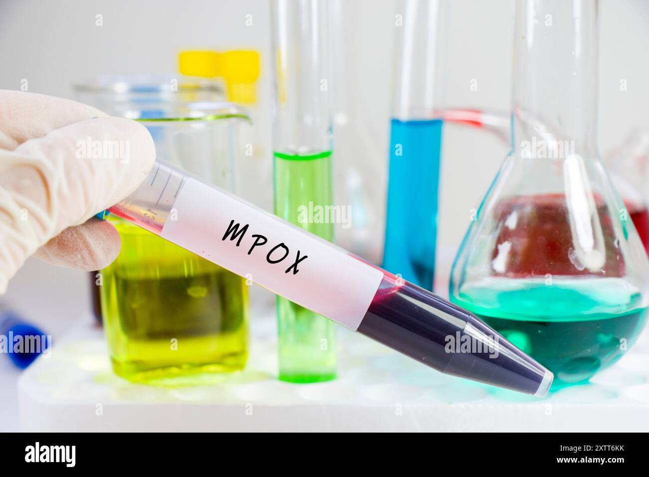 Monkey pox test tube hi-res stock photography and images - Alamy