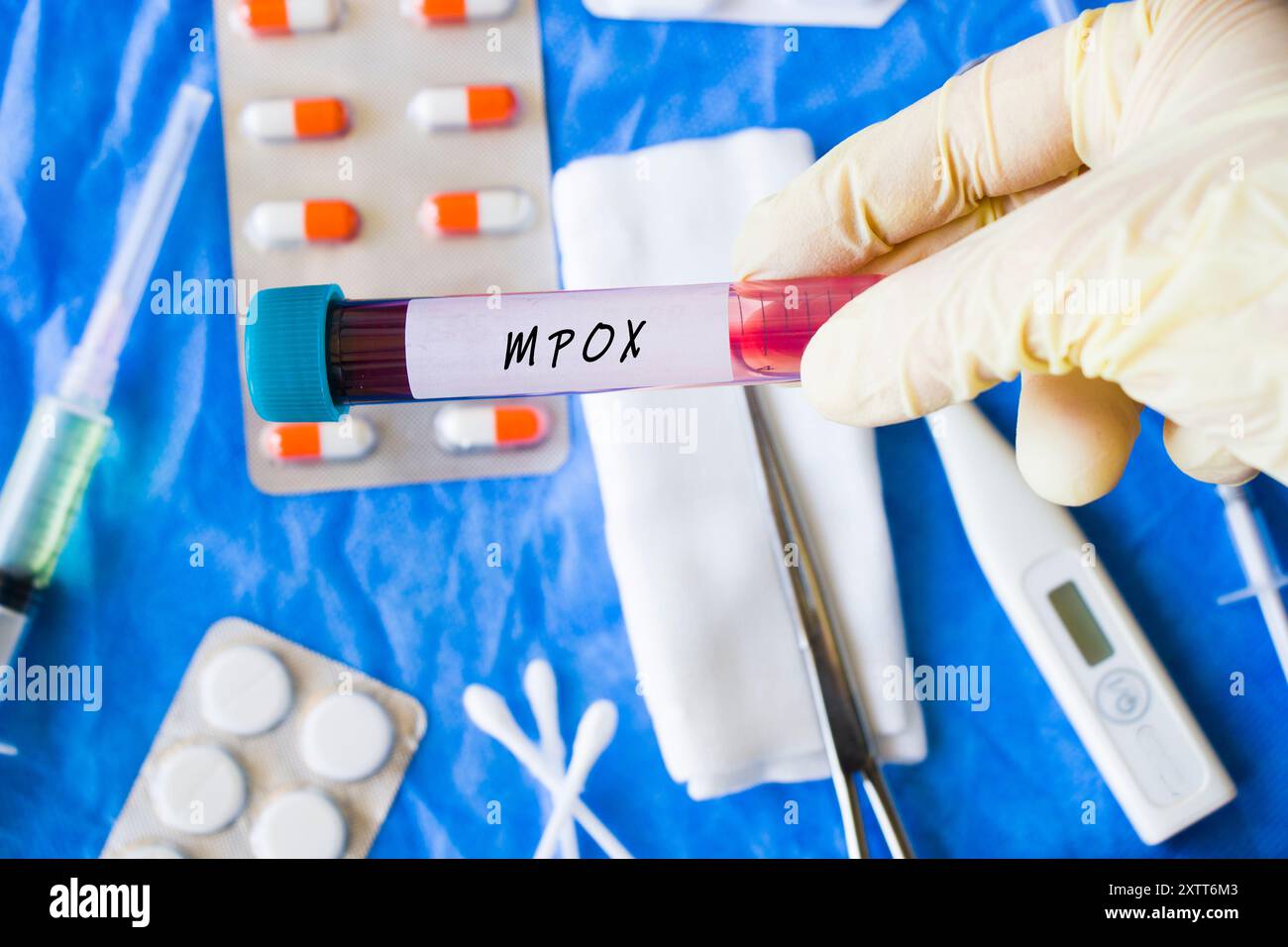 Mpox monkeypox virus, laboratory and blood test tube Stock Photo - Alamy