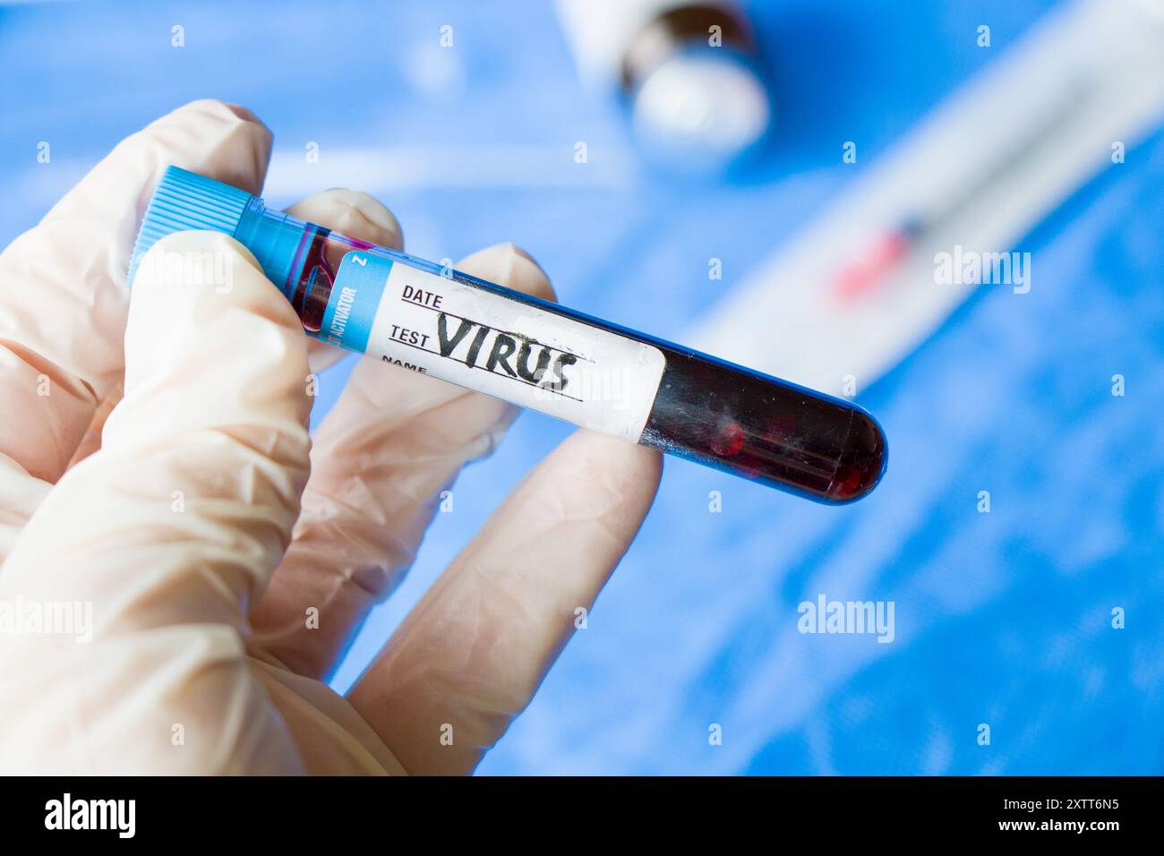 Mpox virus hi-res stock photography and images - Alamy