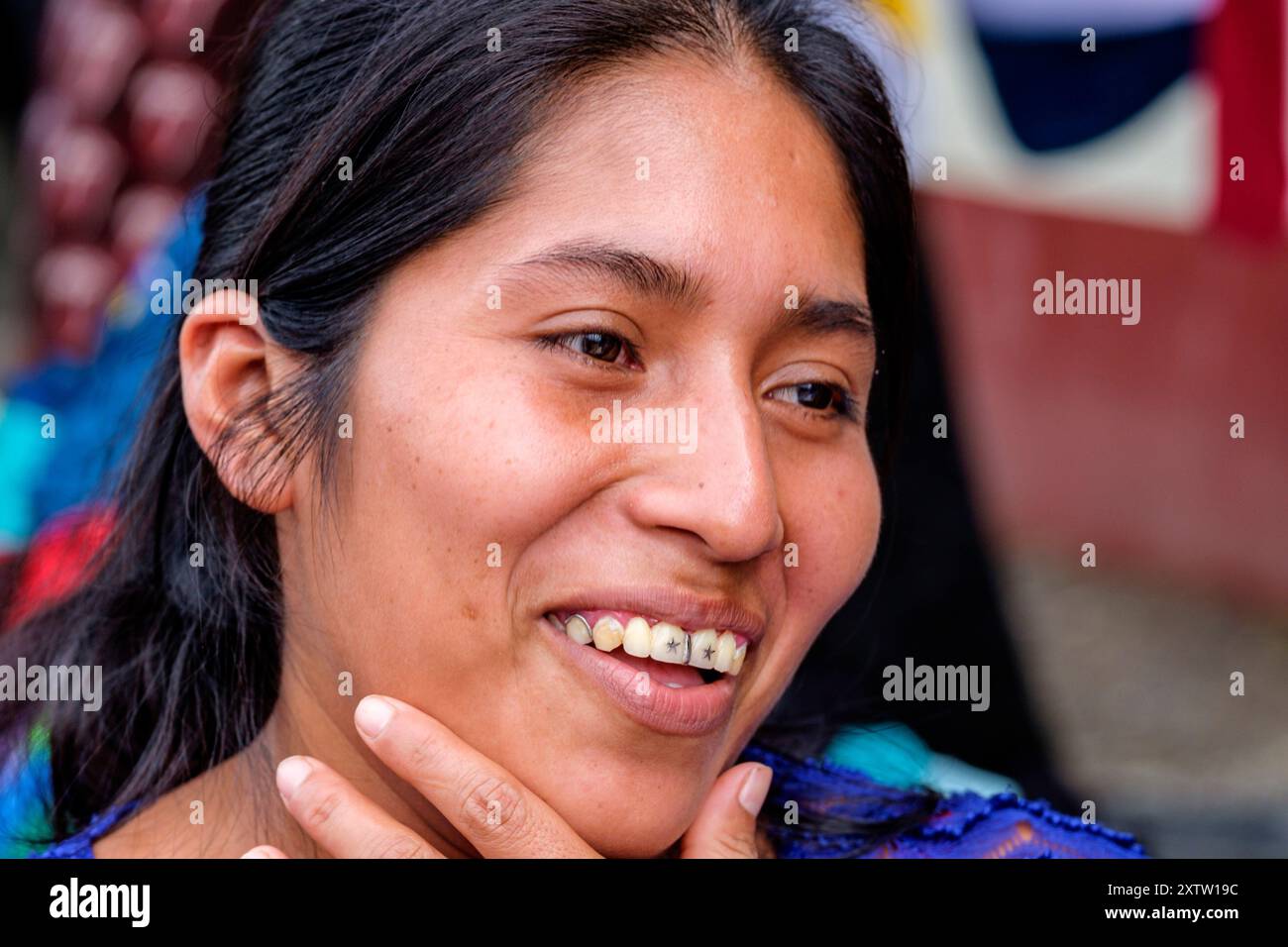 Woman with star shaped braces, Lancetillo La Parroquia, Franja