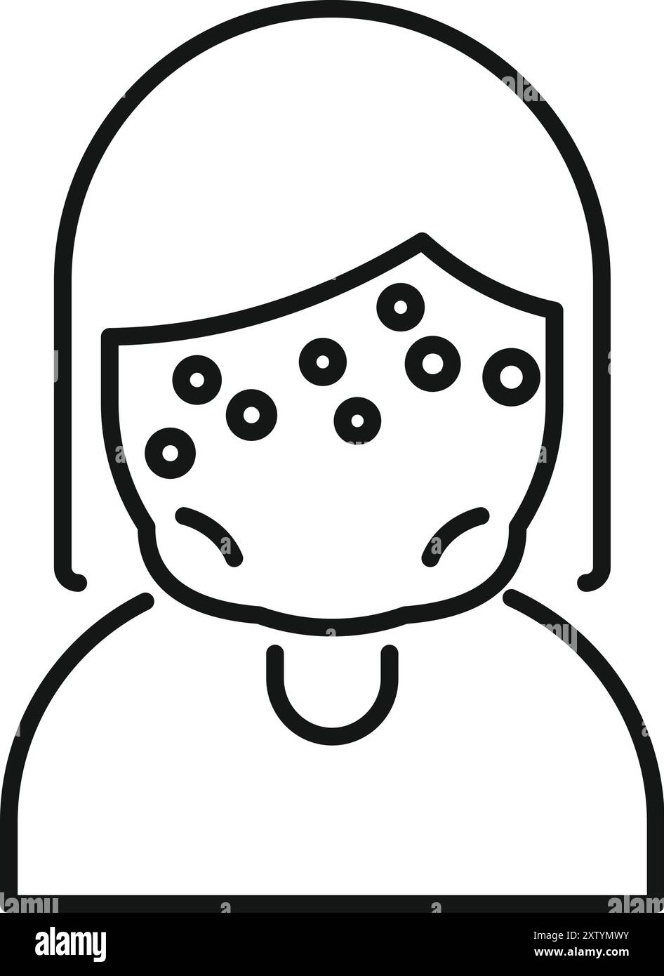 Line icon of a female patient having chickenpox on her forehead Stock ...
