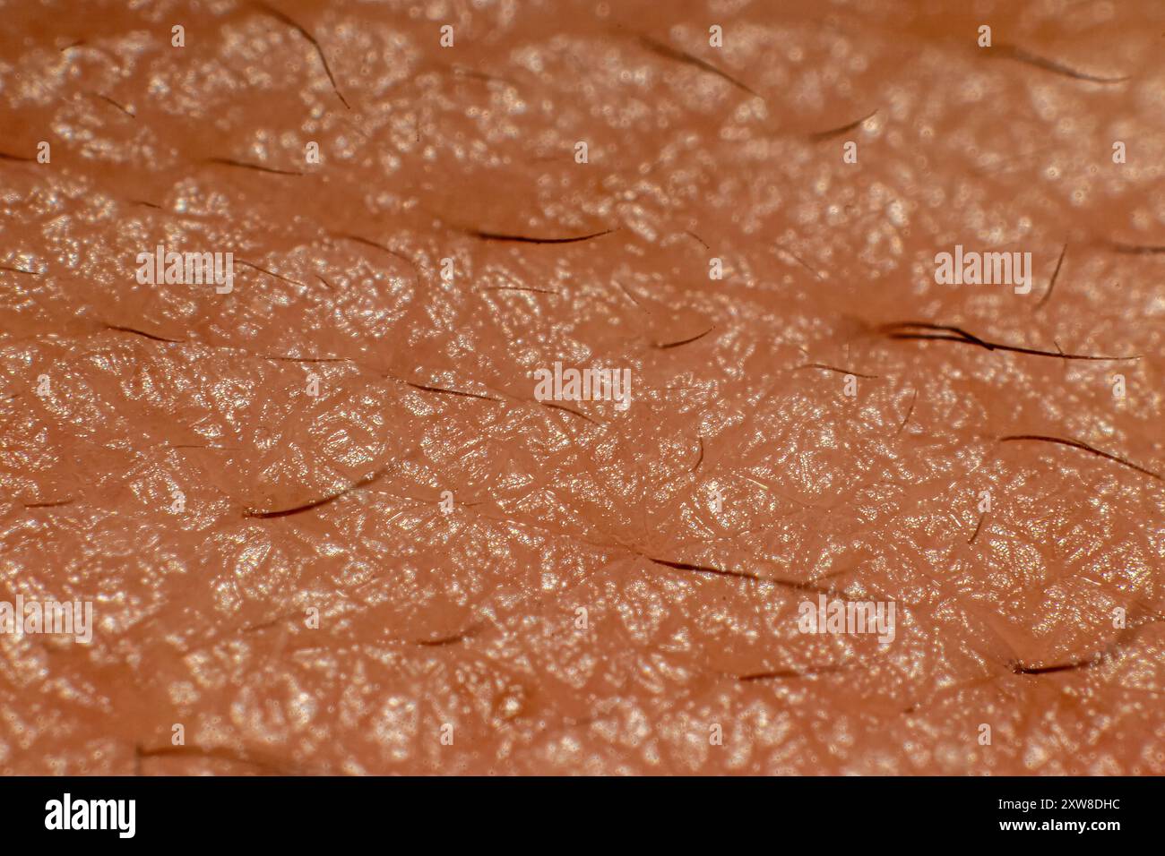 Close-up view of human skin texture, showing fine hairs and pores. Taken in Toronto, Canada. - Stock Image