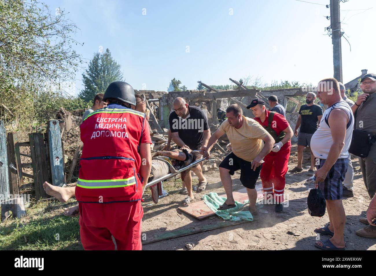 Woman taken away on stretcher hi-res stock photography and images - Alamy