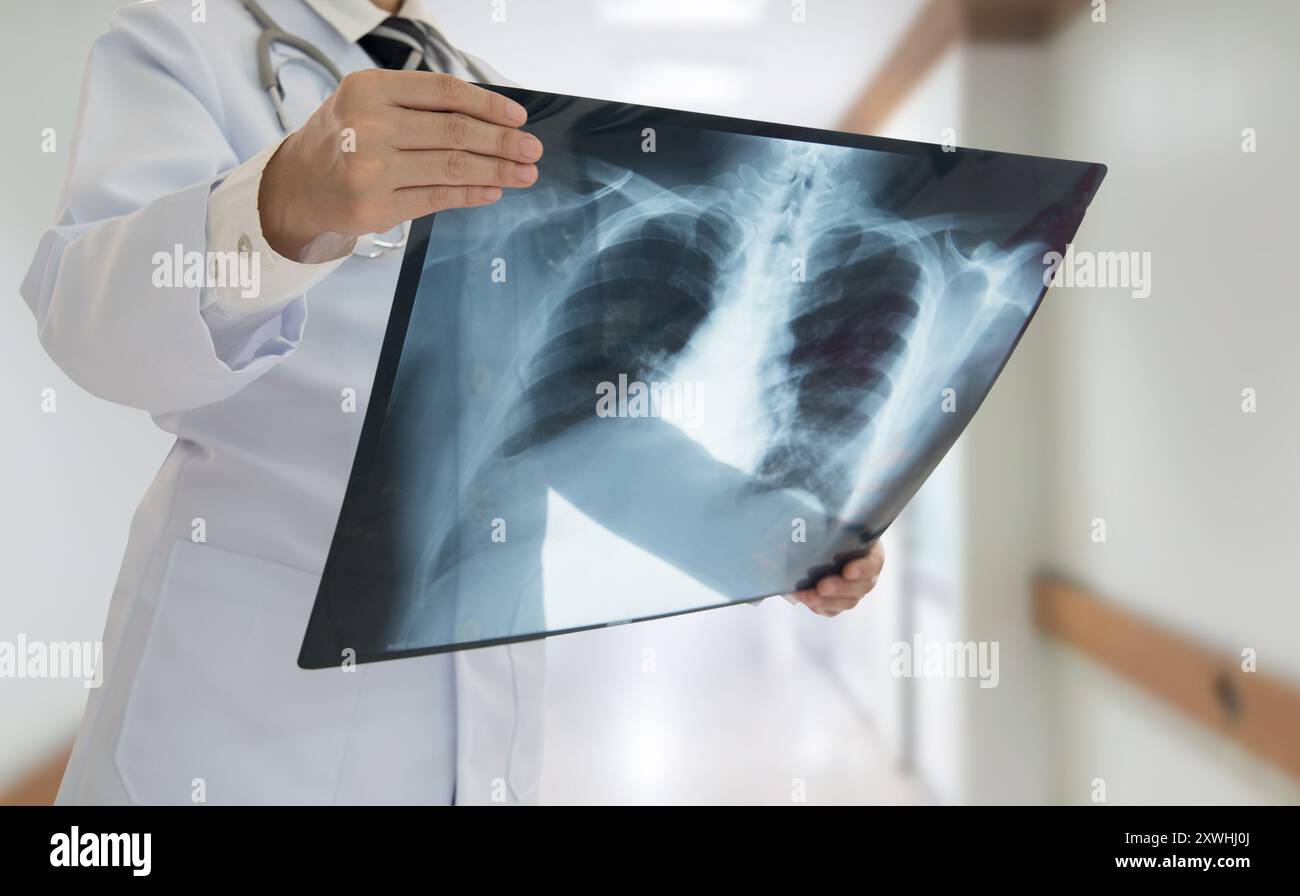 Doctor examining chest x-ray film of patient at hospital Stock Photo ...