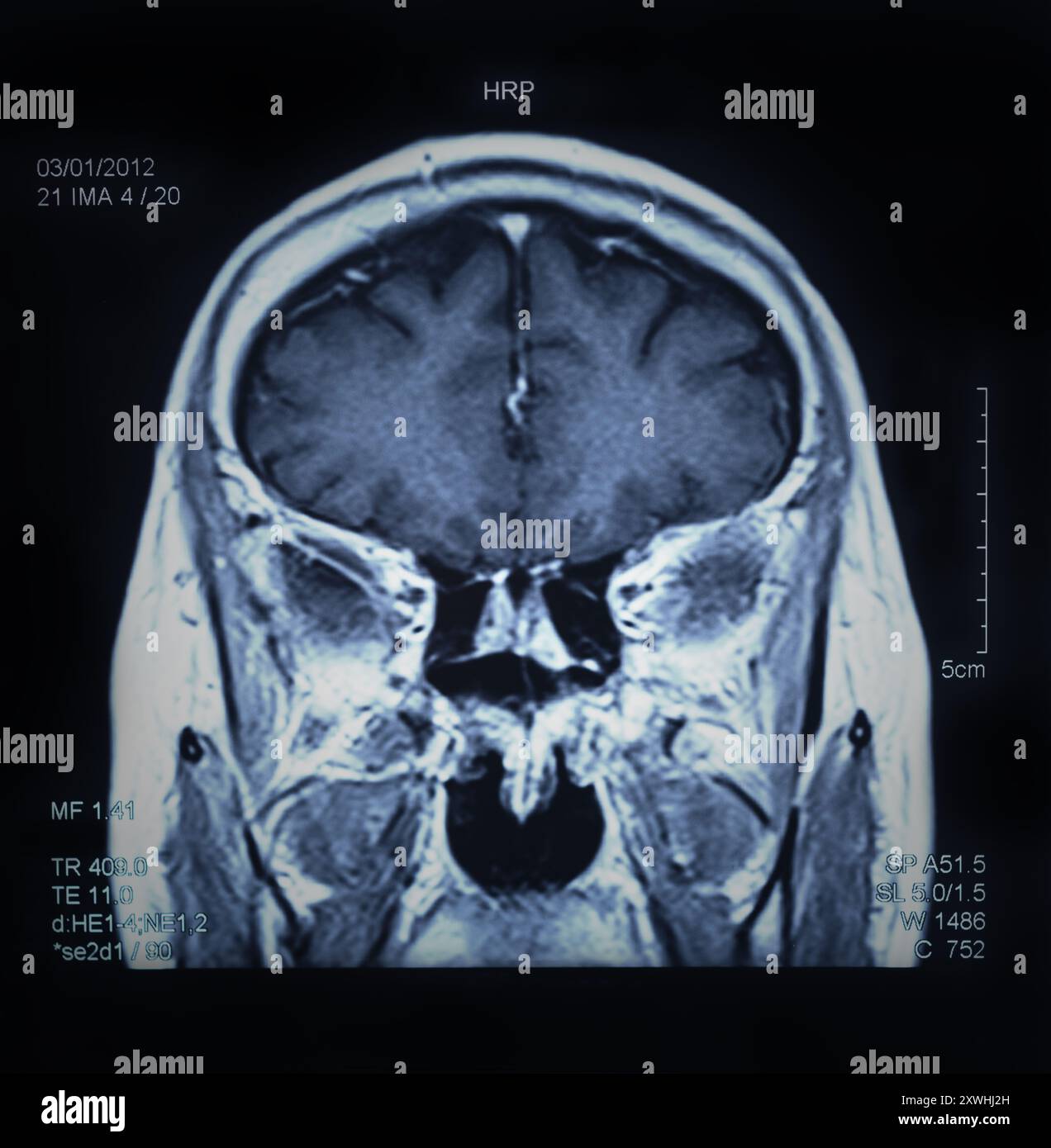 magnetic resonance image, mri scan of the brain Stock Photo - Alamy
