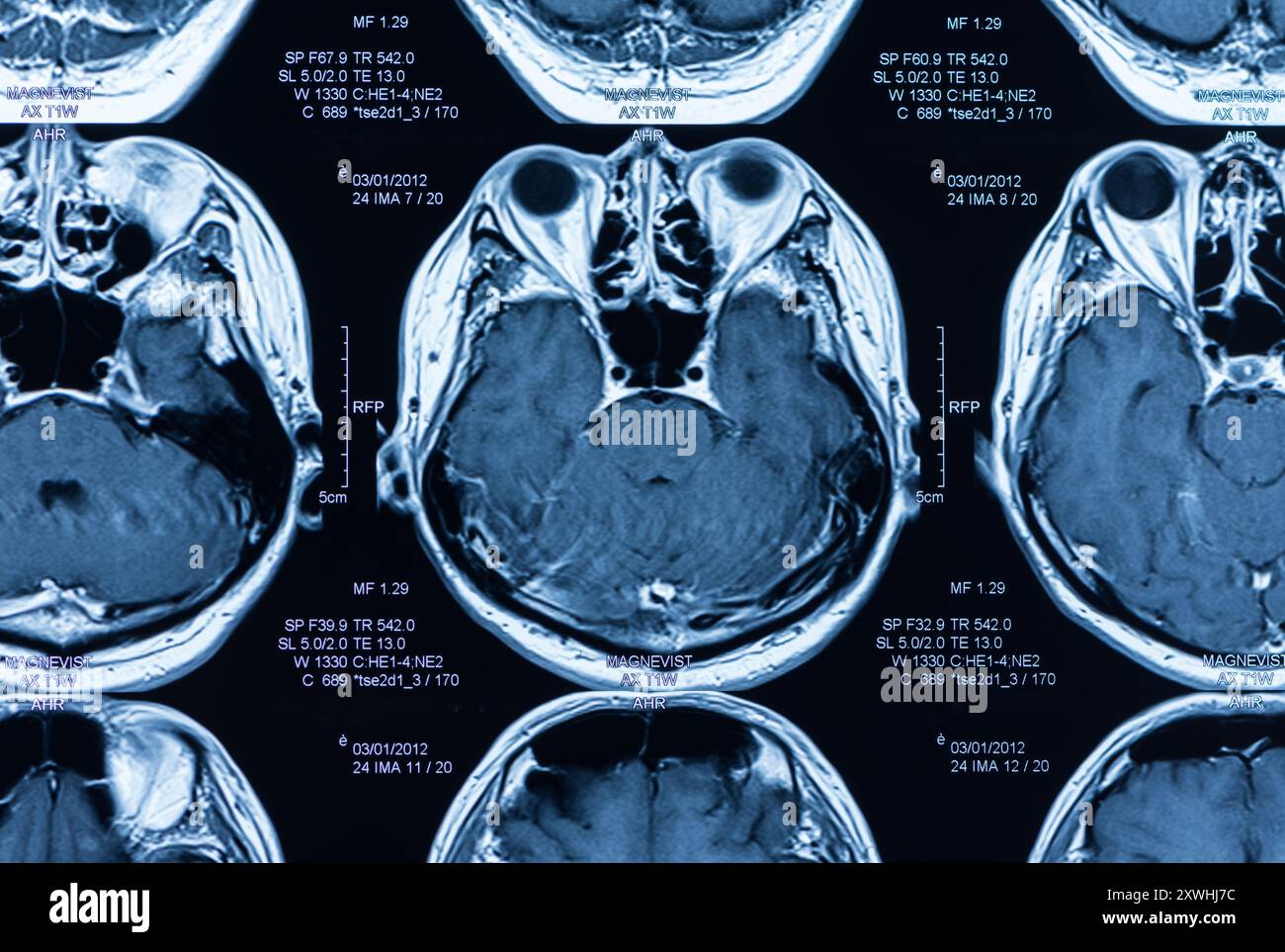 magnetic resonance image, mri scan of the brain Stock Photo - Alamy