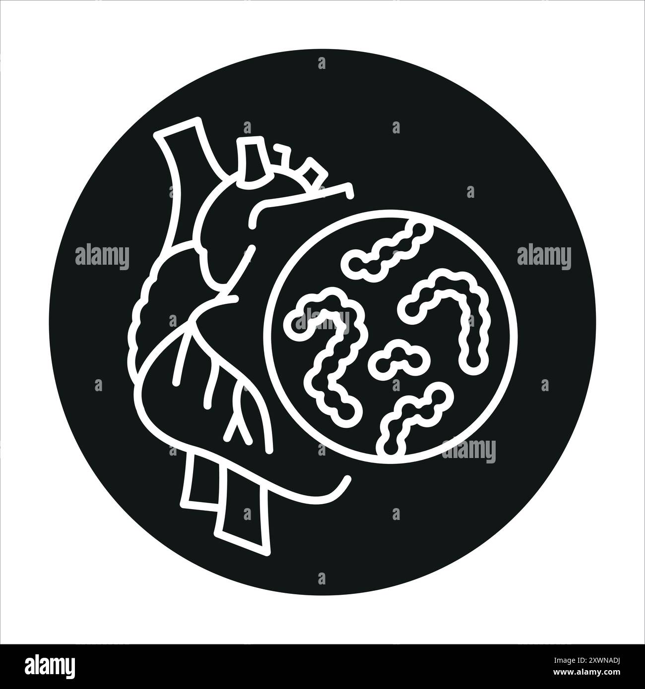 Endocarditis line black icon. Sign for web page, mobile app, button, logo. Vector isolated button. Editable stroke. Stock Vector
