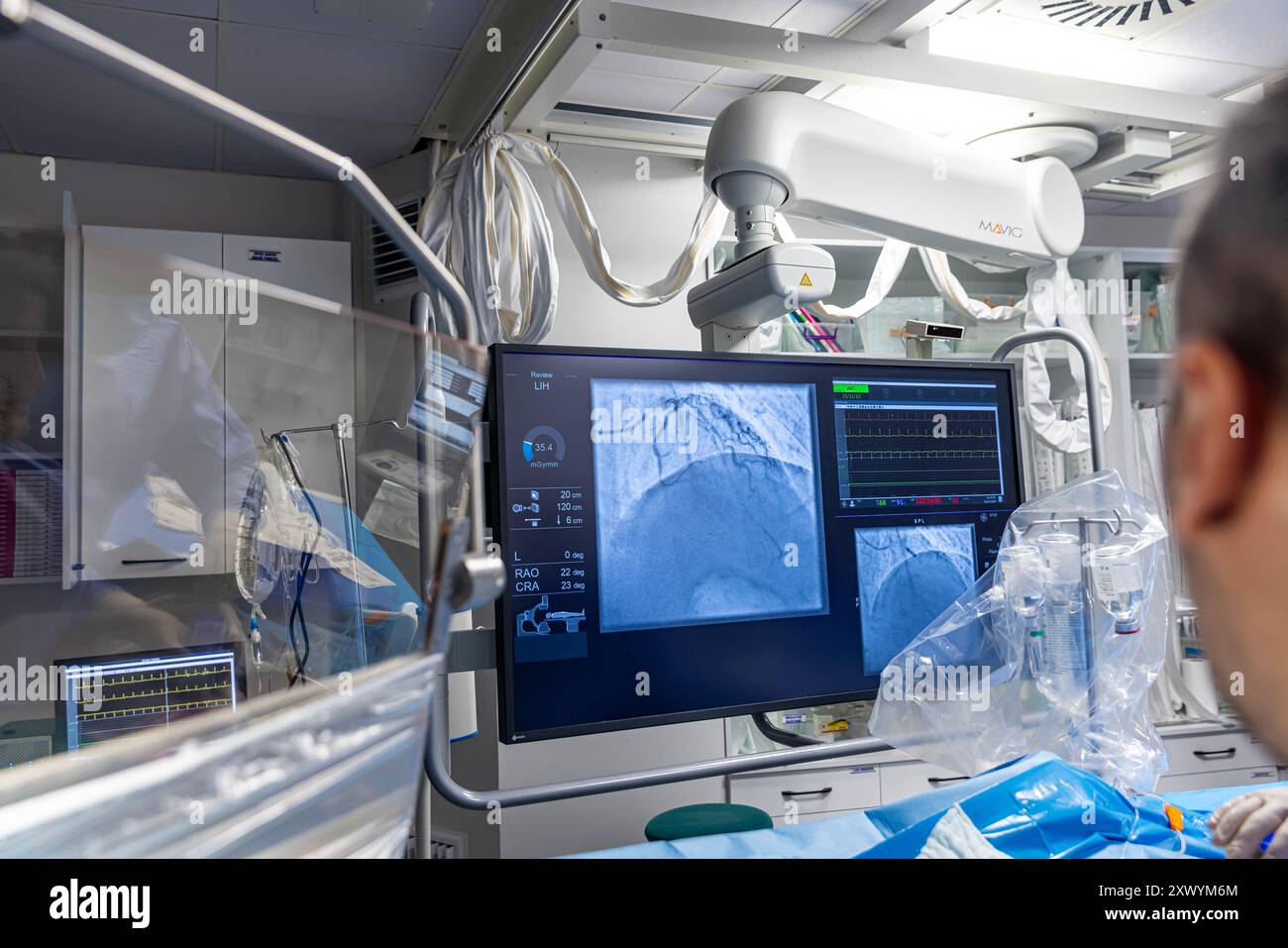 Balloon angioplasty x ray hi-res stock photography and images - Alamy