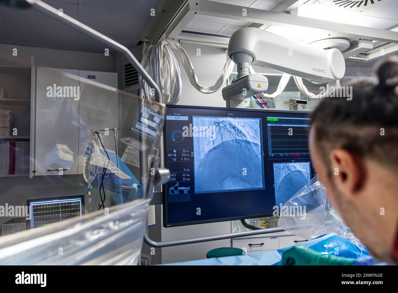 Balloon angioplasty x ray hi-res stock photography and images - Alamy