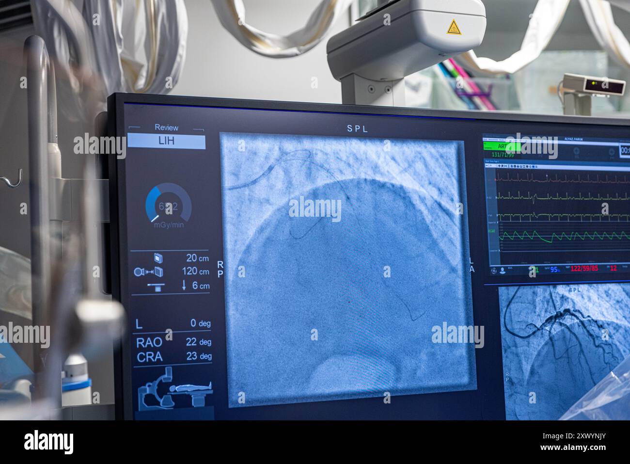 Denizli Turkey-28 February 2024; Doctors conduct a diagnostic operation