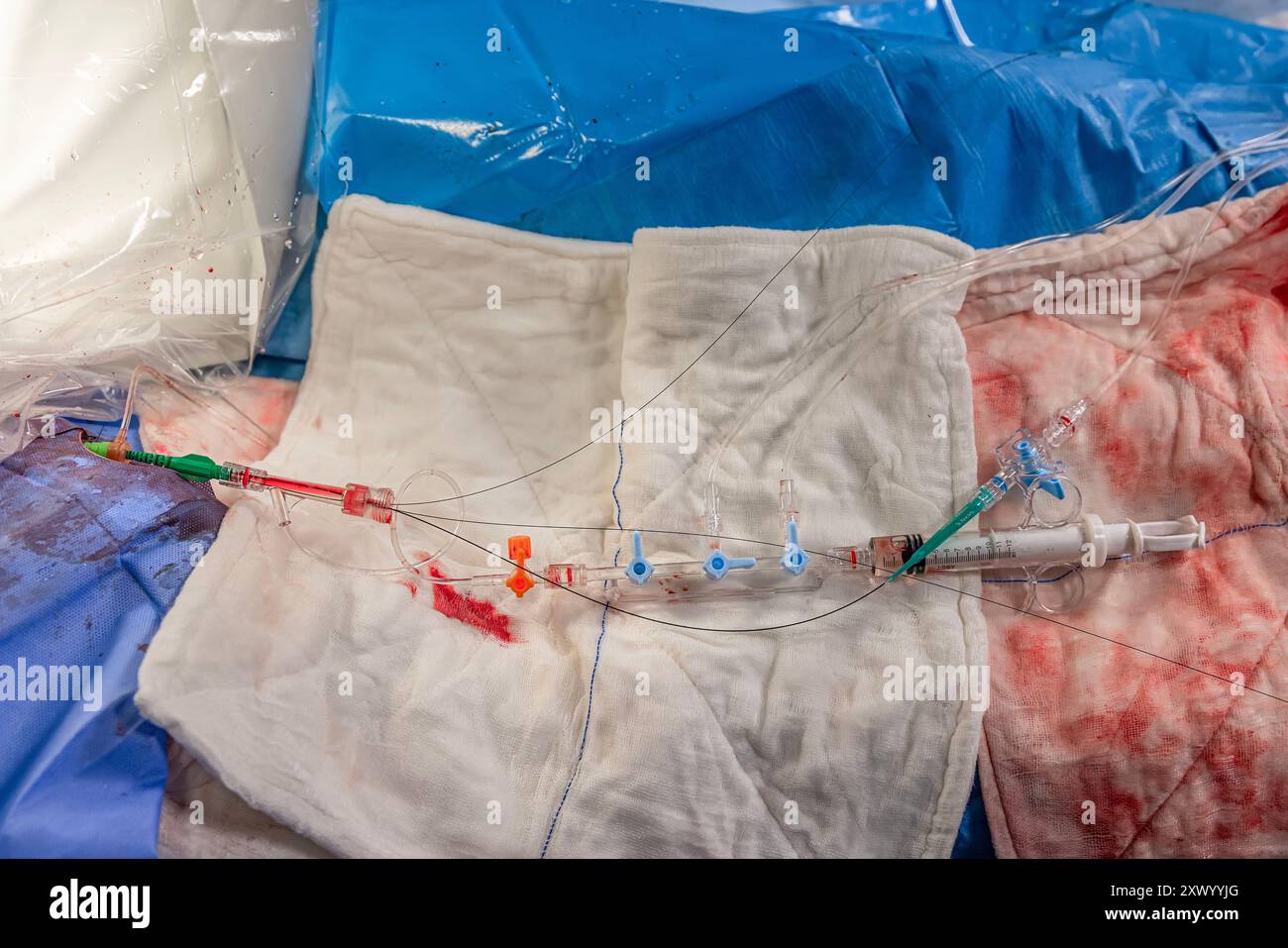 Heart stent placement process in operating room. Heart doctor inserting ...