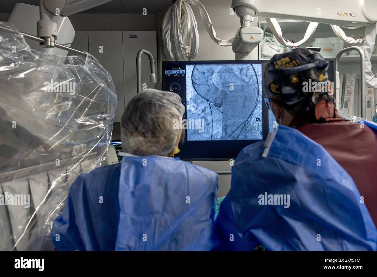 Balloon angioplasty x ray hi-res stock photography and images - Alamy