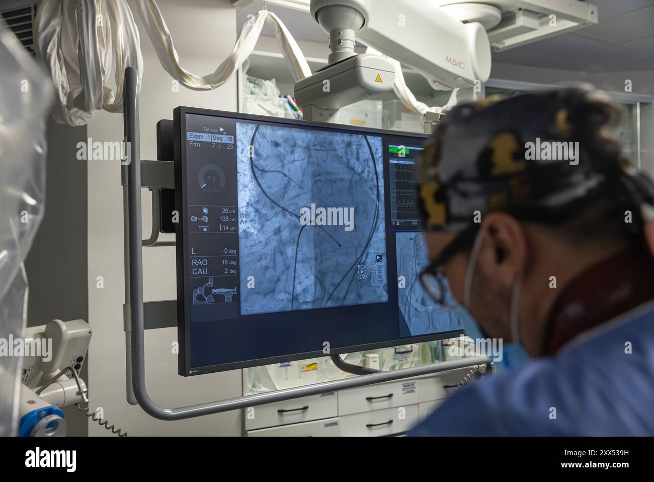 Balloon angioplasty x ray hi-res stock photography and images - Alamy