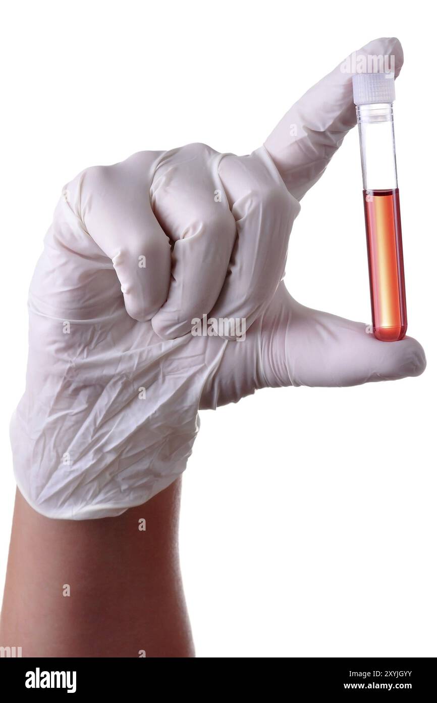 Hand holding a blood sample for analysis, isolated Stock Photo