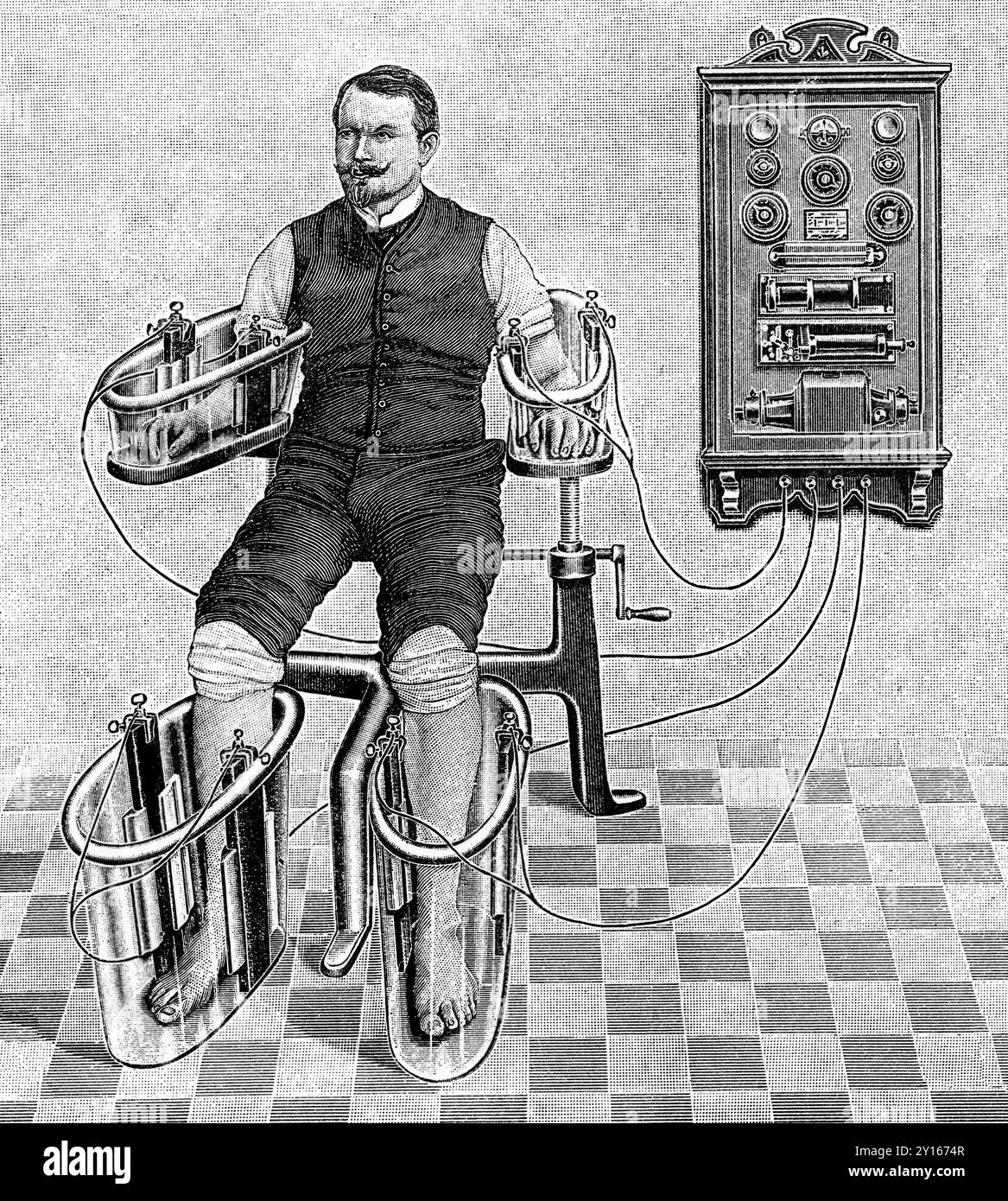 An illustration of a patient being treated with a four cell Schnee Bath, an early electric medical equipment for treating rheumatism Stock Photo