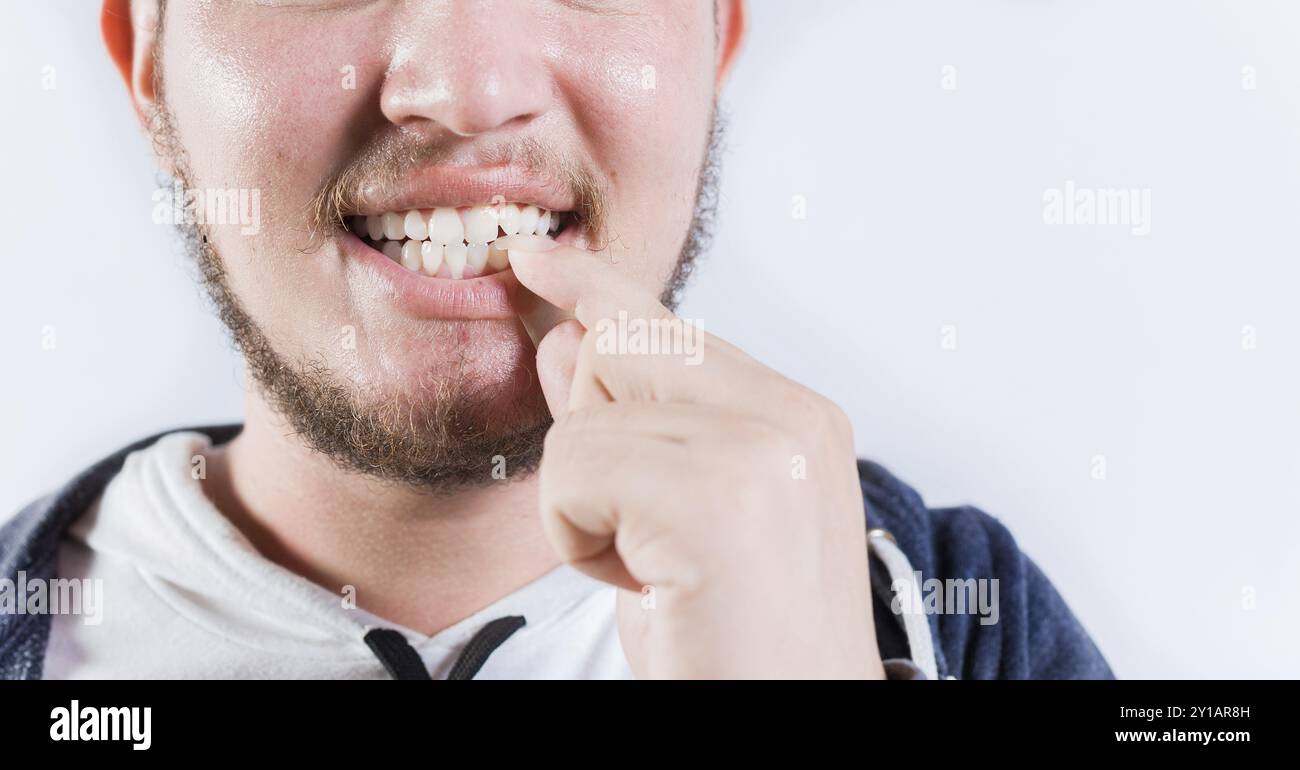 Person biting nails isolated. Close up of man with dermatophagia, biting his nails Stock Photo