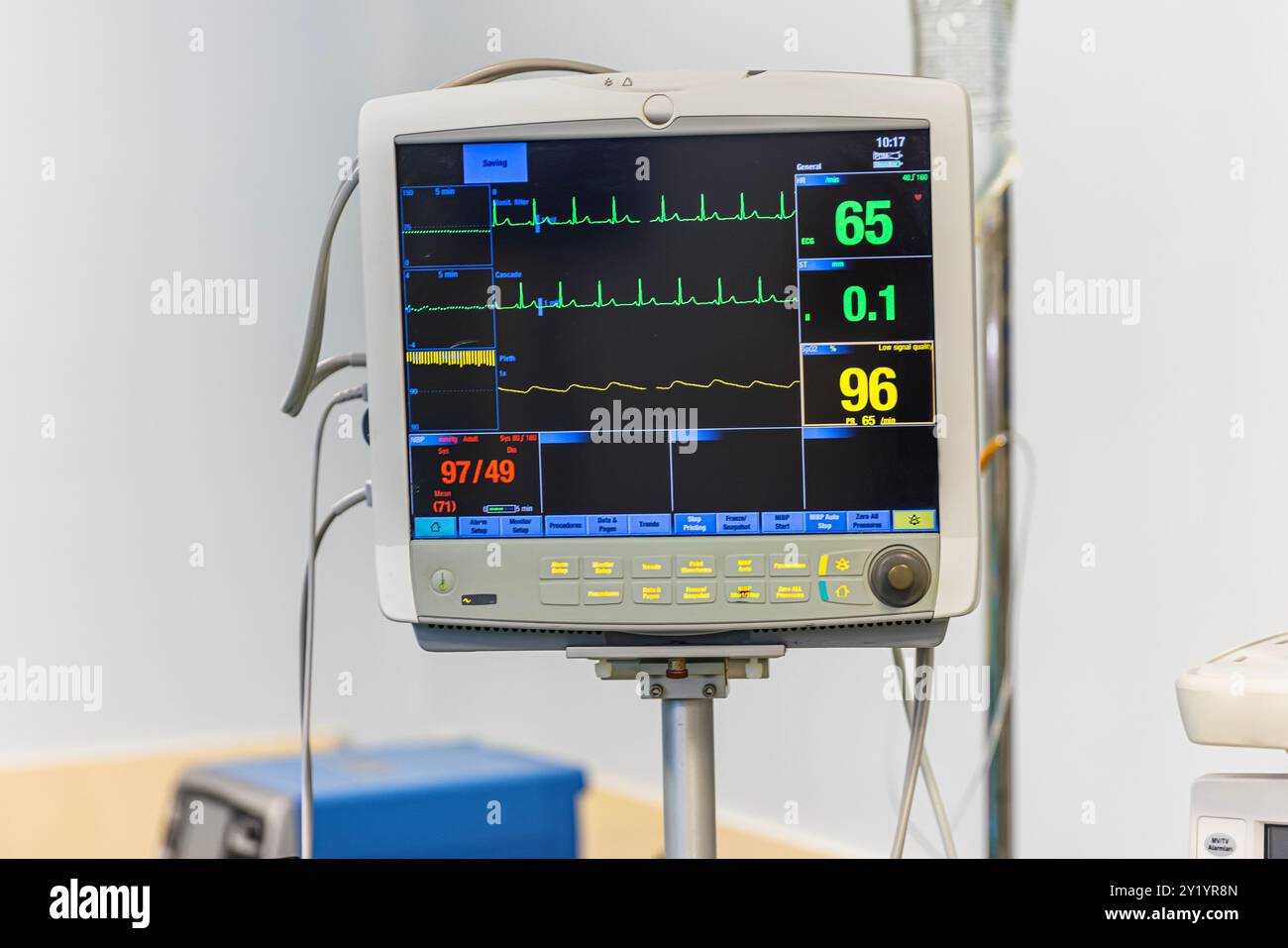 Vital Signs Monitoring