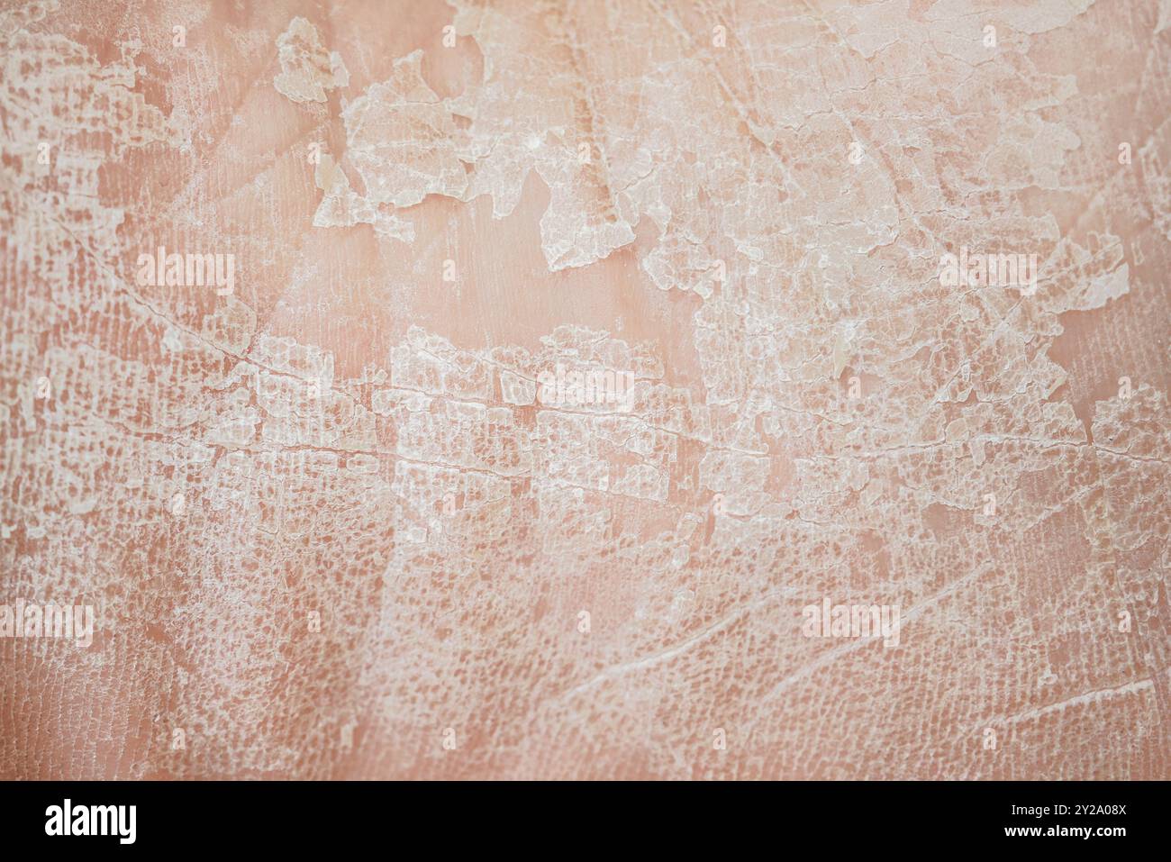 Normal to oily skin hi-res stock photography and images - Alamy