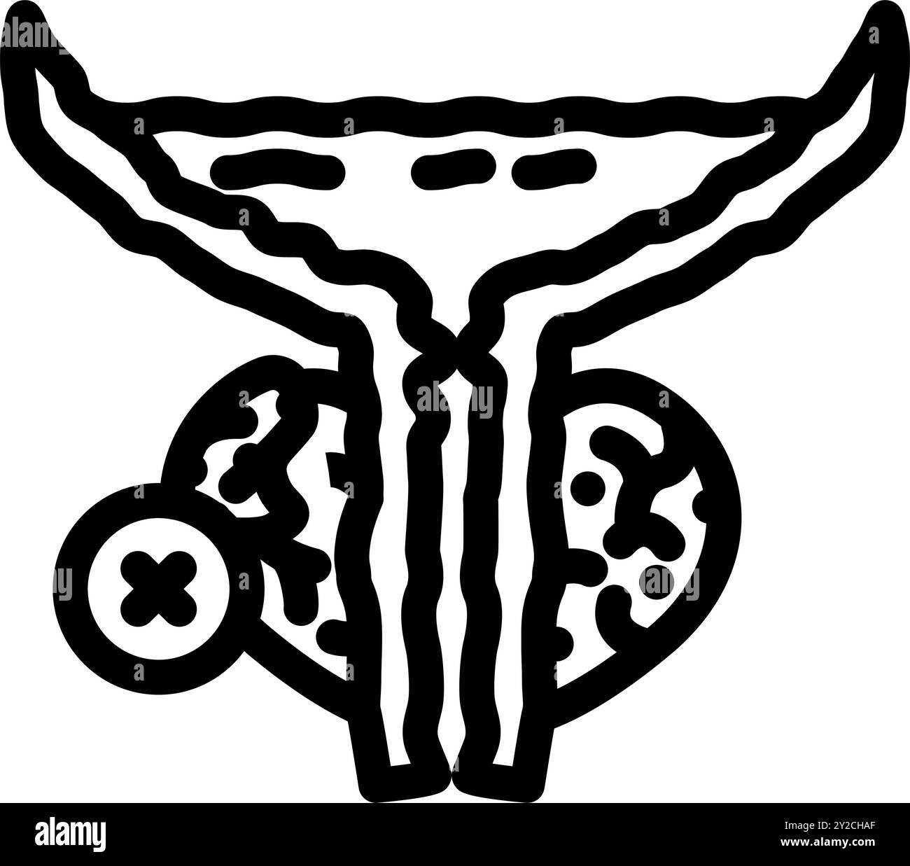 Prostatectomy Stock Vector Images - Alamy