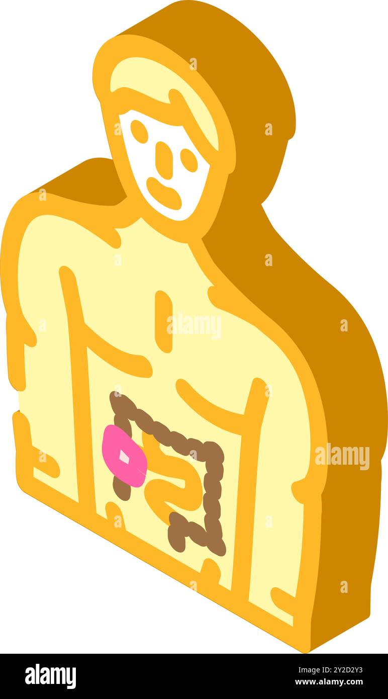 colostomy surgery isometric icon vector illustration Stock Vector Image ...