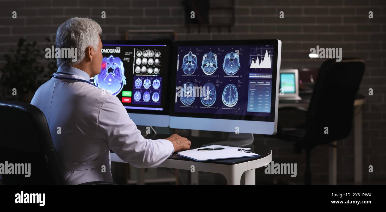 Dementia brain scans hi-res stock photography and images - Alamy